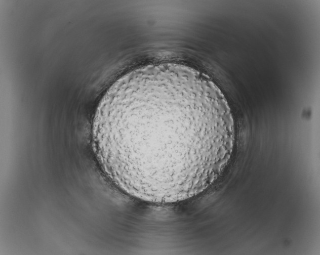 X0000111590469200908061354