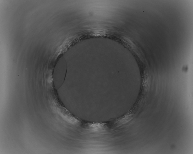 X0000111590516200908061353