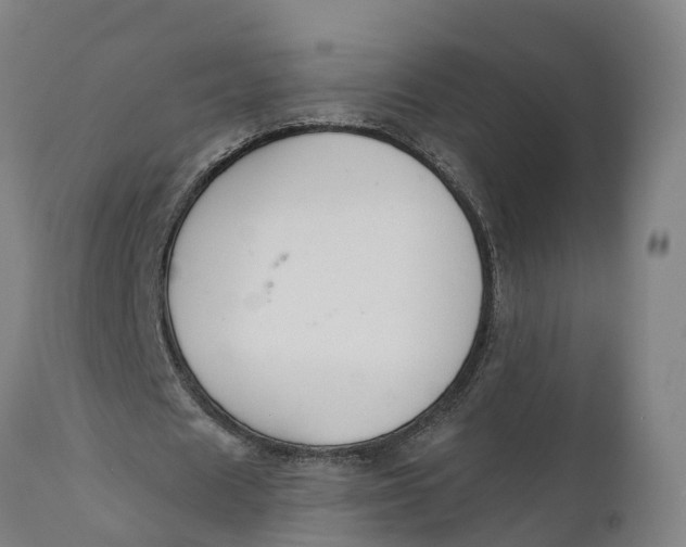 X0000111590625200908061350