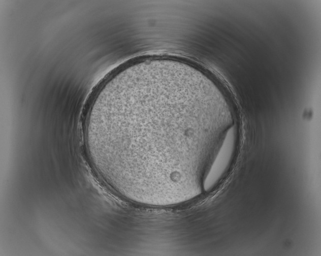 X0000111590876200908061347