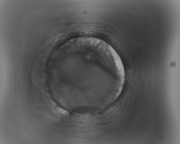 X0000111591009200908061344