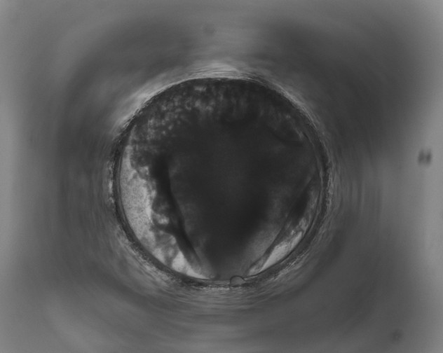 X0000111591455200908061337