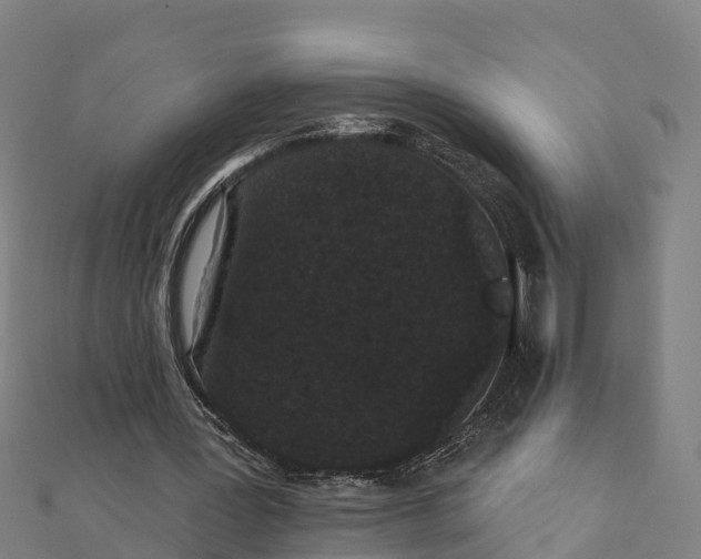 X0000111590387200908131345