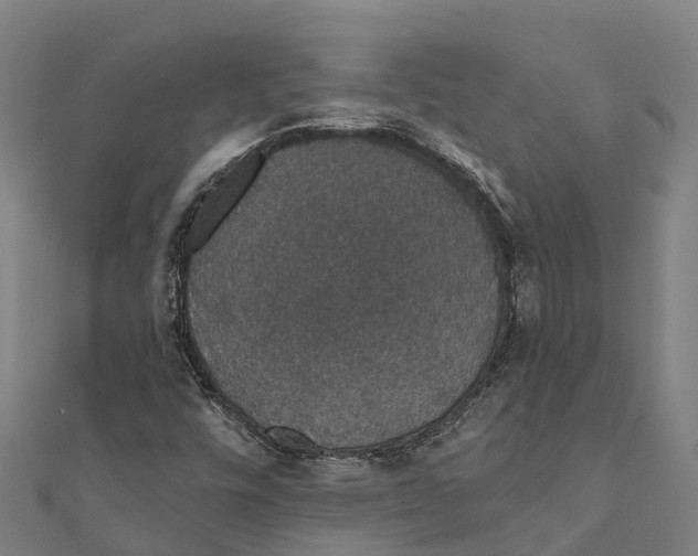 X0000111591448200908131330