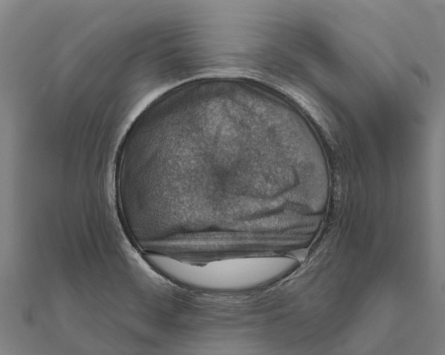 X0000111591468200908131330