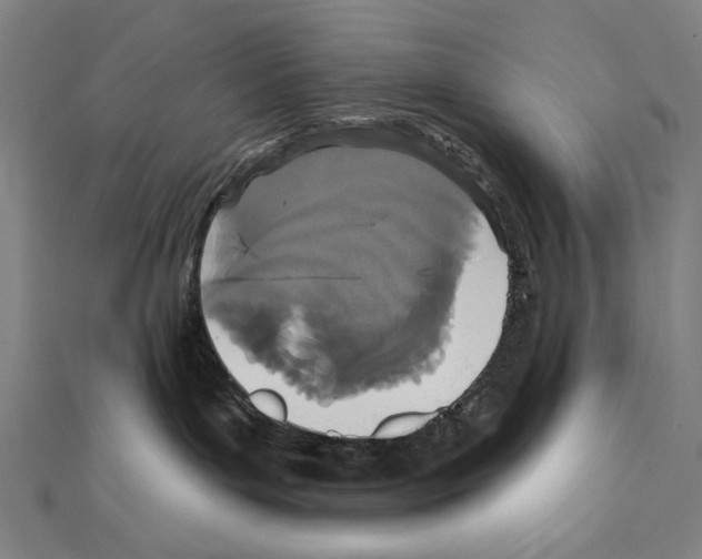 X0000111590143200908271017