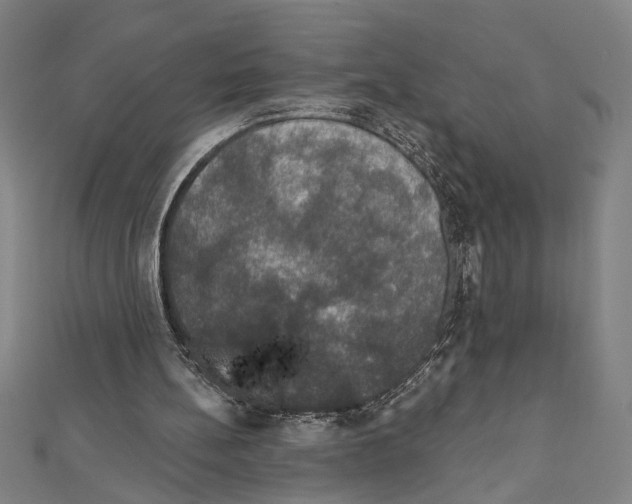 X0000111590148200908271016