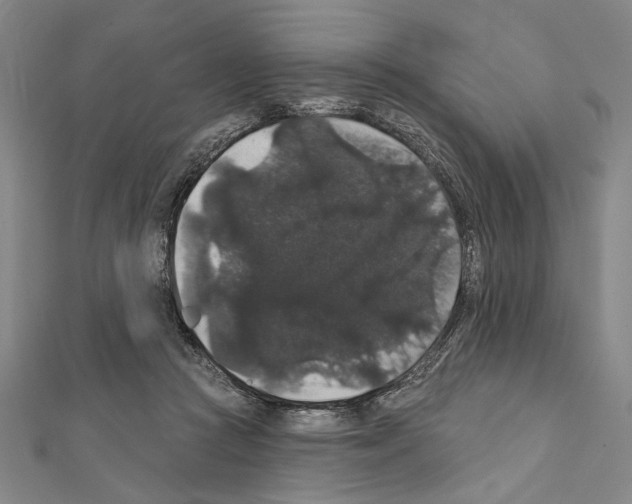 X0000111590361200908271014