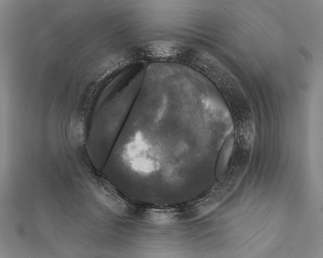 X0000111590556200908271011