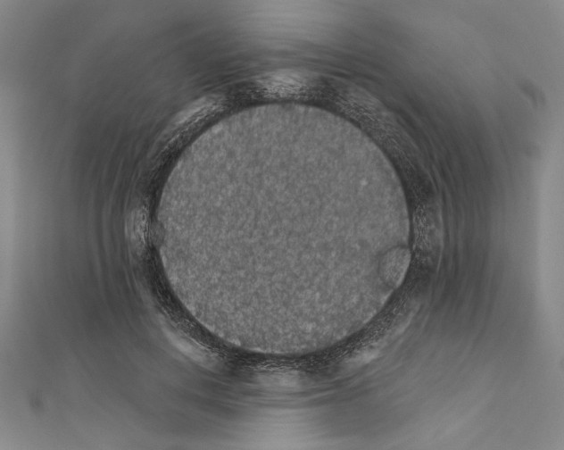 X0000111590648200908271010