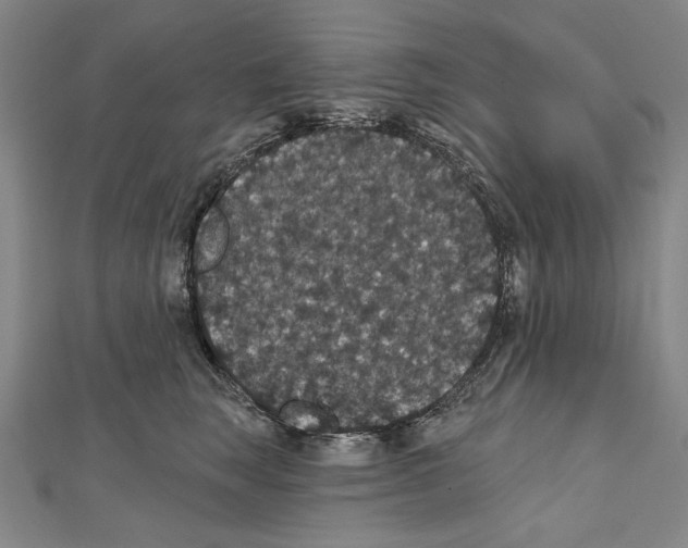 X0000111590663200908271010