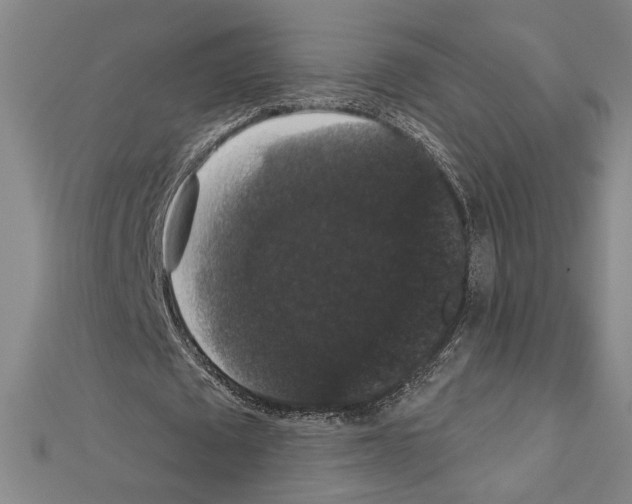 X0000111590673200908271010