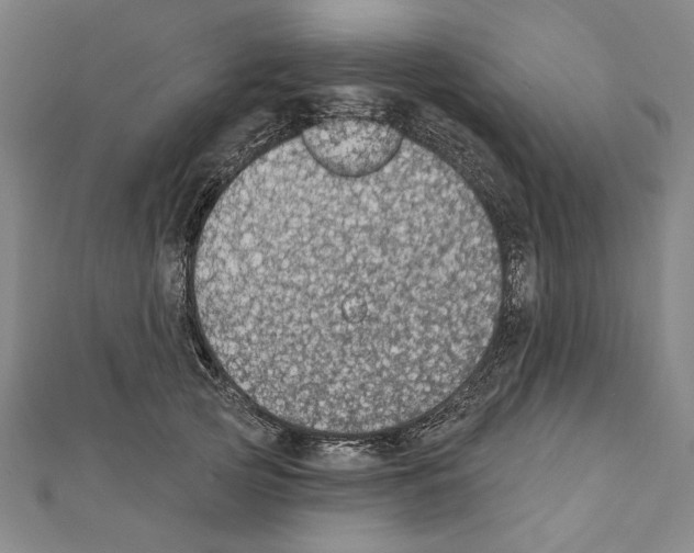X0000111590753200908271009