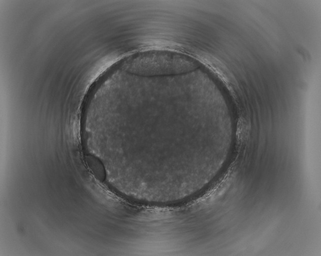 X0000111590877200908271007