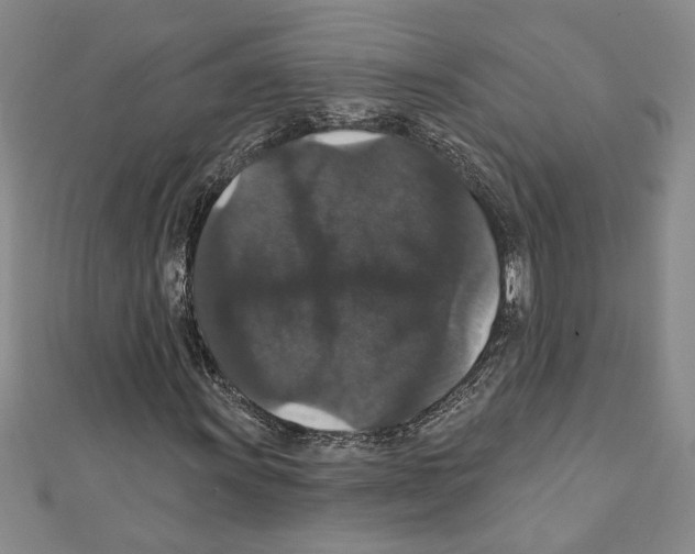 X0000111591011200908271005