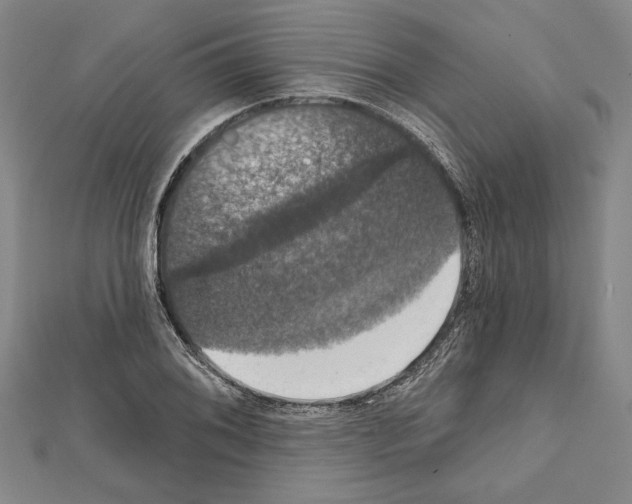 X0000111591076200908271004