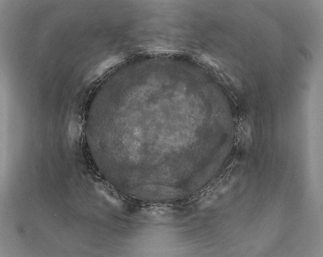 X0000111591157200908271003