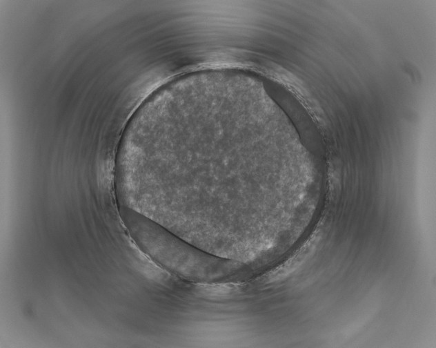 X0000111591185200908271003