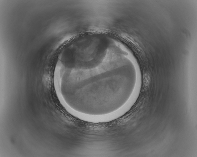 X0000111591254200908271001