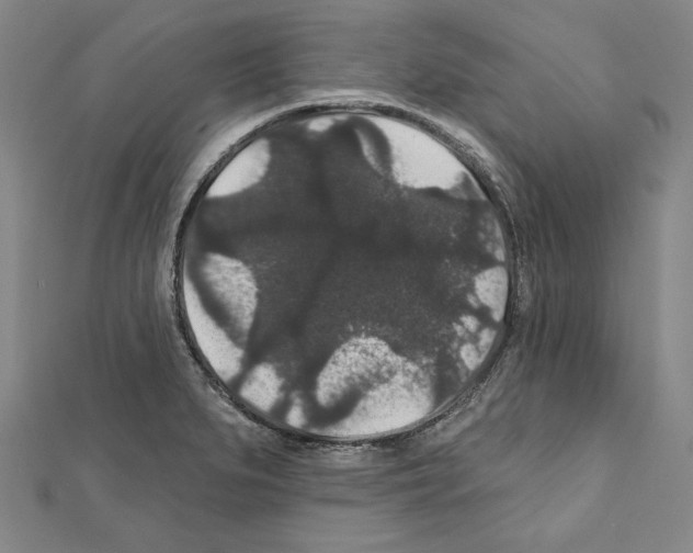 X0000111591279200908271001
