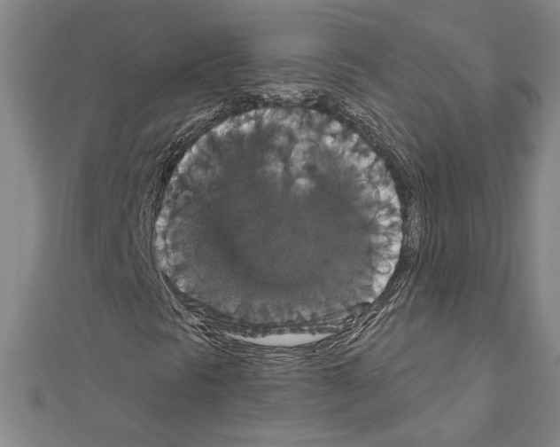 X0000111591297200908271000