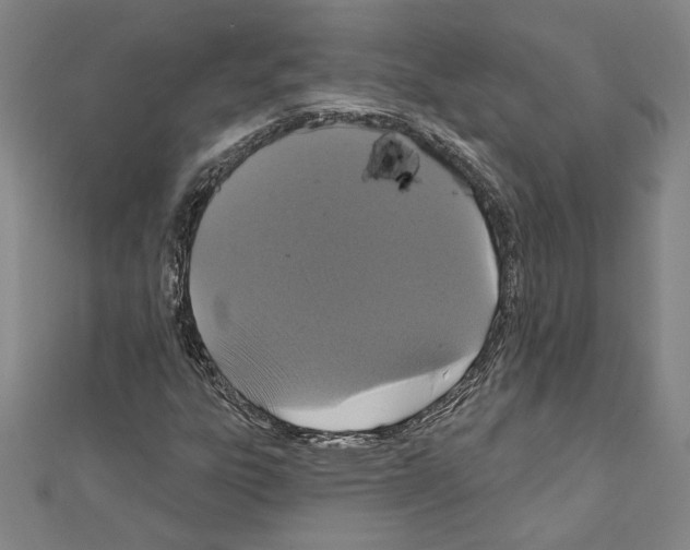 X0000111591303200908271000