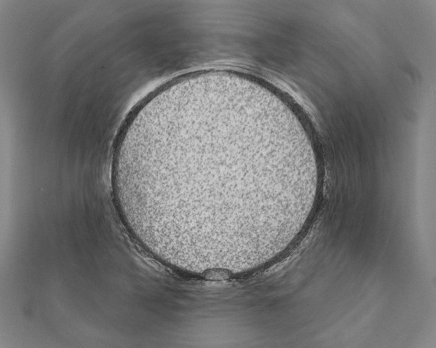 X0000111591316200908271000