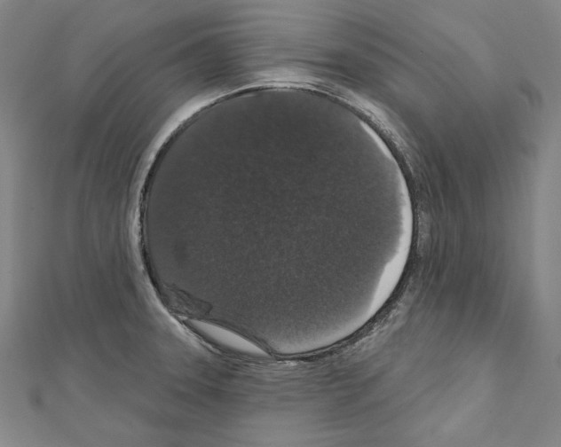 X0000111591331200908271000