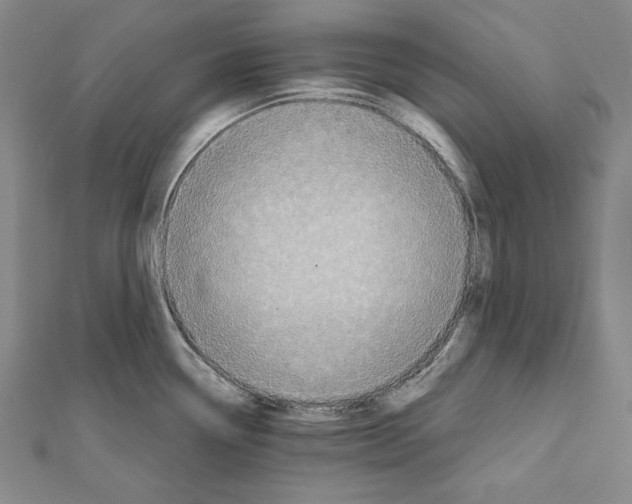 X0000111591338200908271001