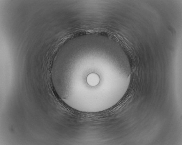 X0000111591345200908271000