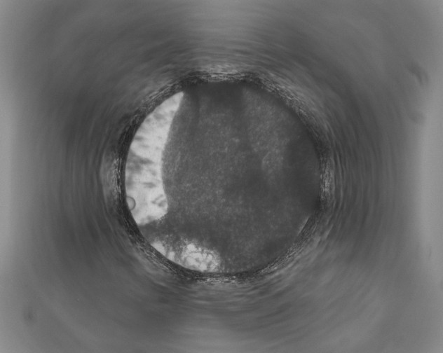 X0000111591346200908271000
