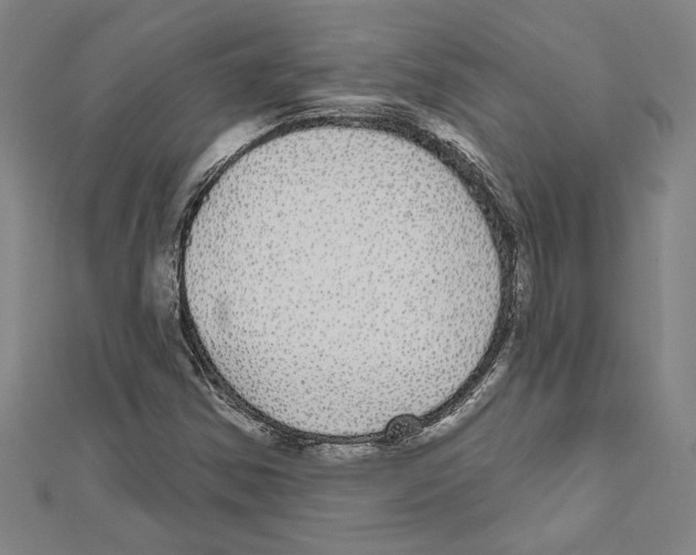 X0000111591354200908271000