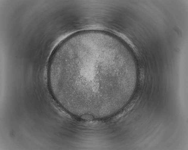 X0000111591364200908271000