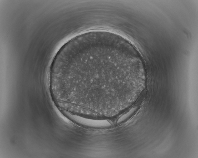 X0000111591519200908270957