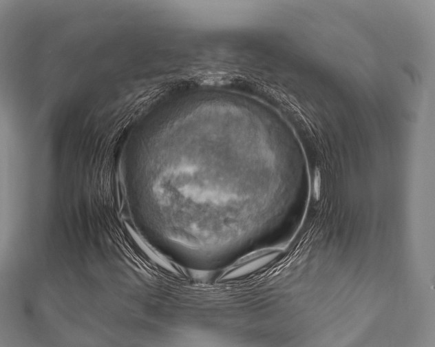 X0000111601444200907231225