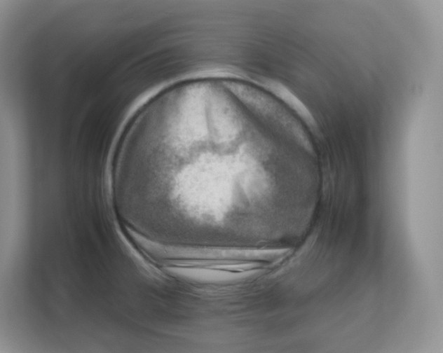 X0000111601380200907301438