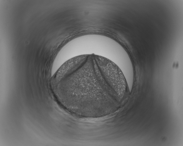 X0000111600025200908061424