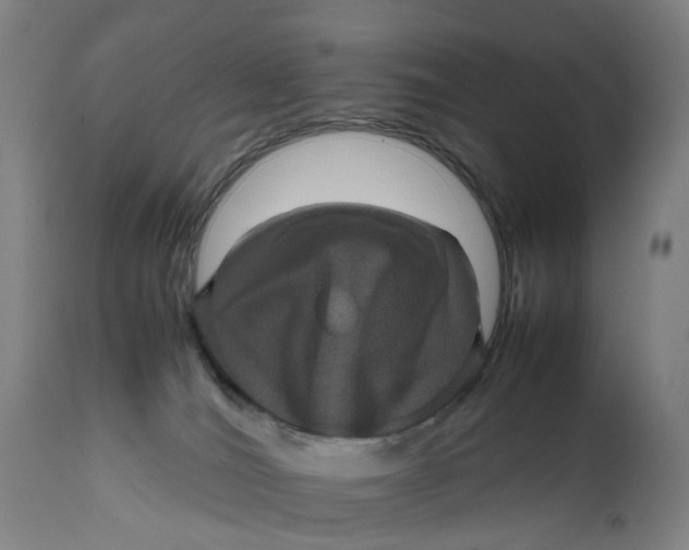 X0000111600036200908061424