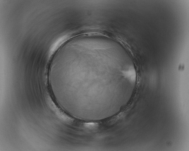 X0000111600053200908061423