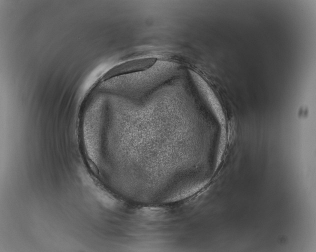 X0000111600150200908061422