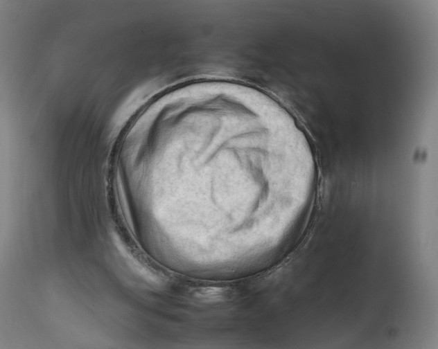 X0000111600151200908061422