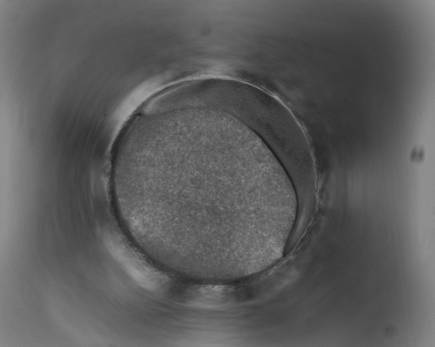 X0000111600152200908061422