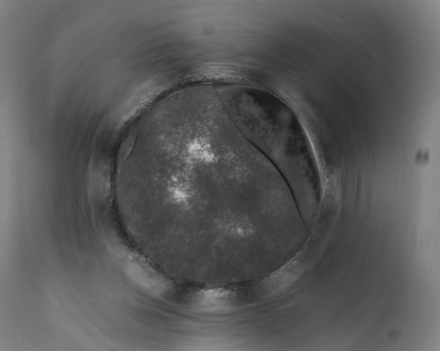 X0000111600158200908061422