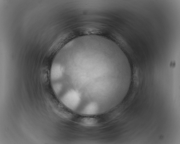 X0000111600169200908061422