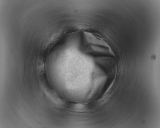 X0000111600176200908061422