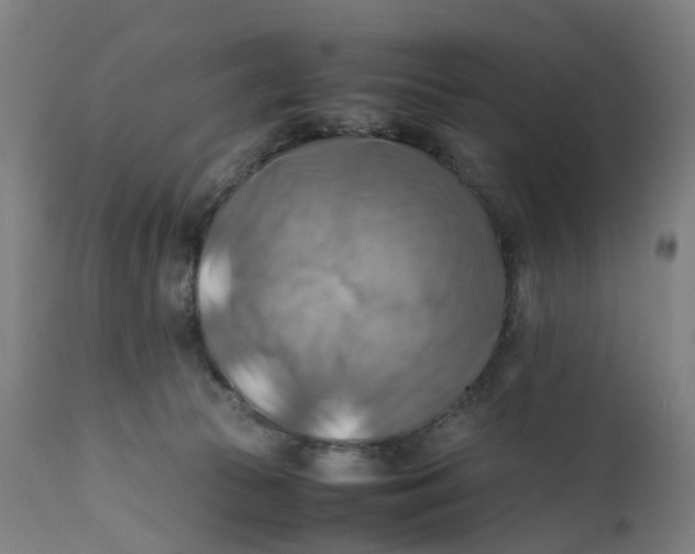 X0000111600177200908061422