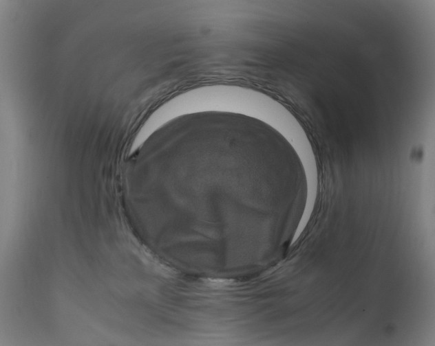 X0000111600233200908061421