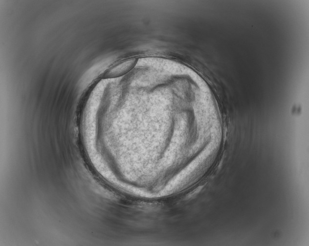 X0000111600245200908061420