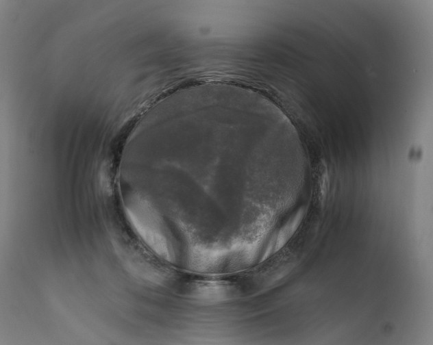 X0000111600316200908061420