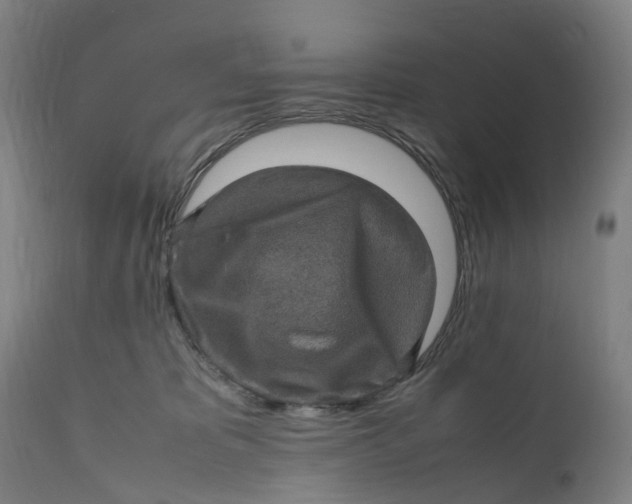 X0000111600325200908061420